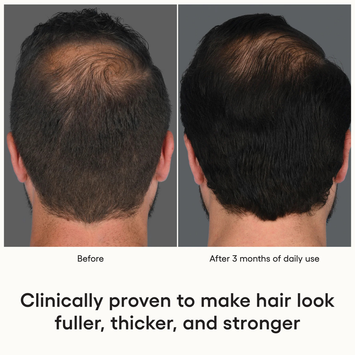 Hair Serum | ( plated )™ Skin Science